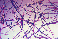 Микрофотография бацилл сибирской язвы. Окраска по Граму