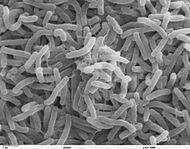 Vibrio cholerae: Холерный вибрион под электронным микроскопом