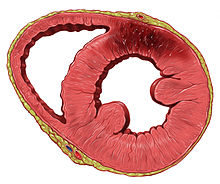 Инфаркт передней стенки левого желудочка сердца.