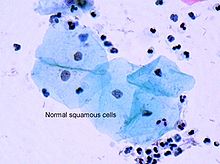 220px-Squamous_cells