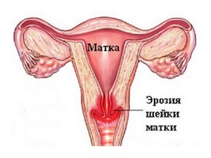 Gynecology_020