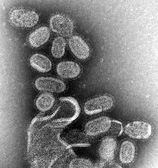 Микрофотография вируса гриппа, снятая при помощи электронного просвечивающего микроскопа, увеличивающего примерно в сто тысяч раз