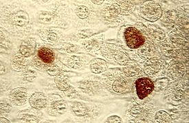 275px-ChlamydiaTrachomatisEinschlusskörperchen